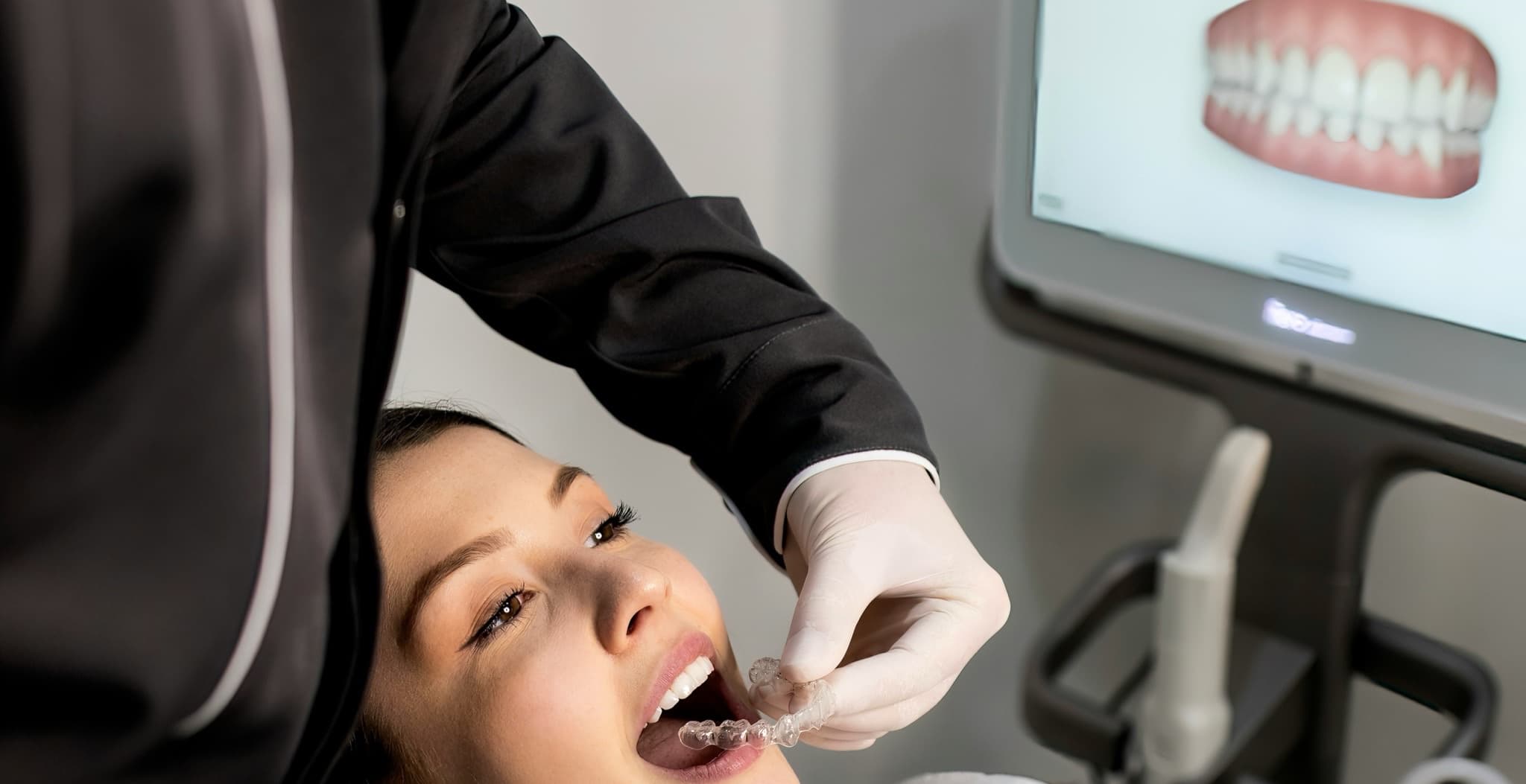 Orthodontist fitting a clear aligner with a digital smile simulation on the chairside monitor